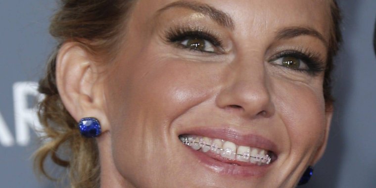 Синди Кроуфорд с брекетами