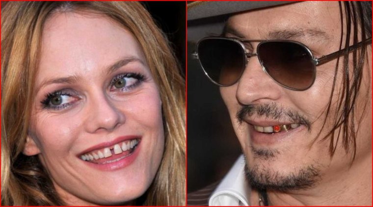 Джулия Робертс зубы кариес