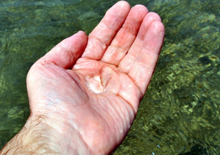 Укус медузы крестовика Владивосток